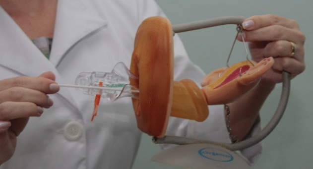 Coleta citopatológica